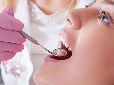 Sweet Tooth Dentistry | Preventative Program, Veneers and Full Mouth Rejuvenation